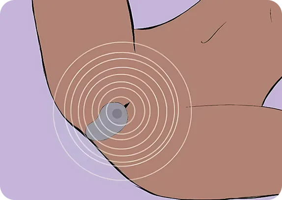 how to use-melt
