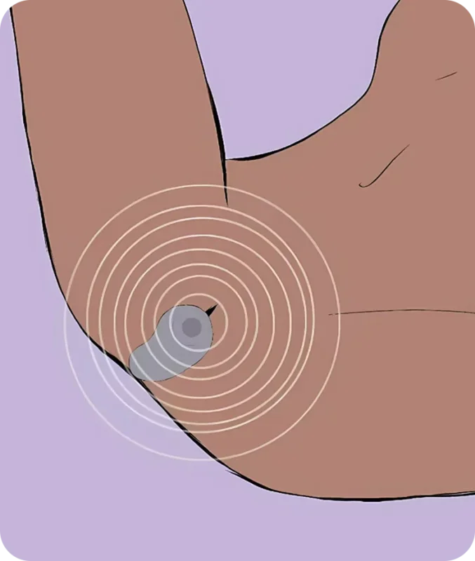 how to use-melt